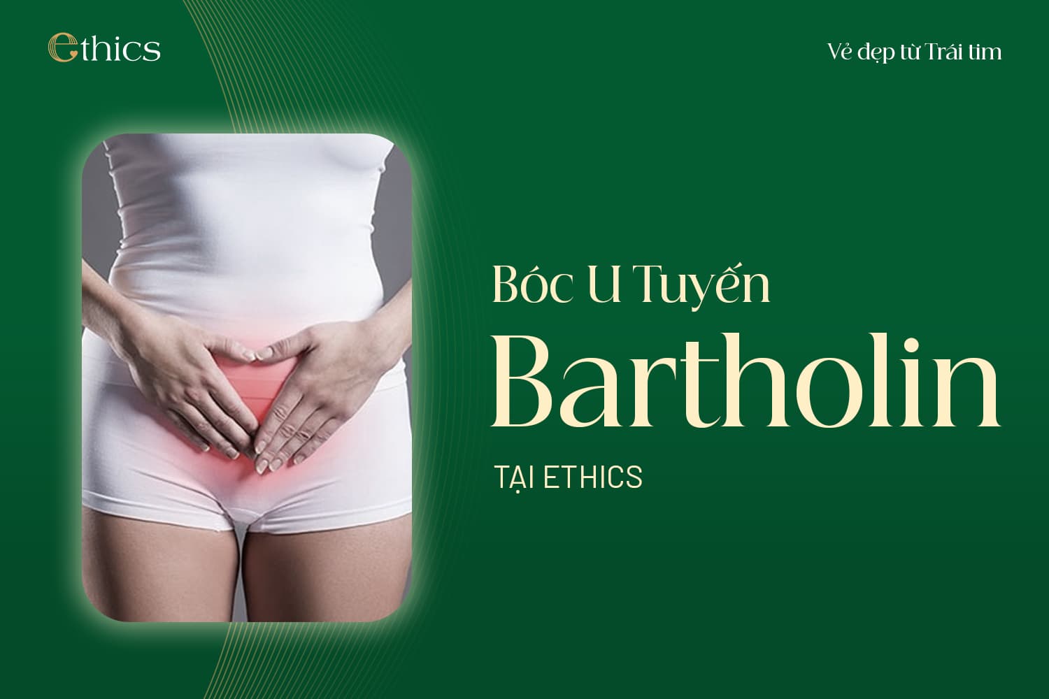Ablation du kyste de la glande de Bartholin