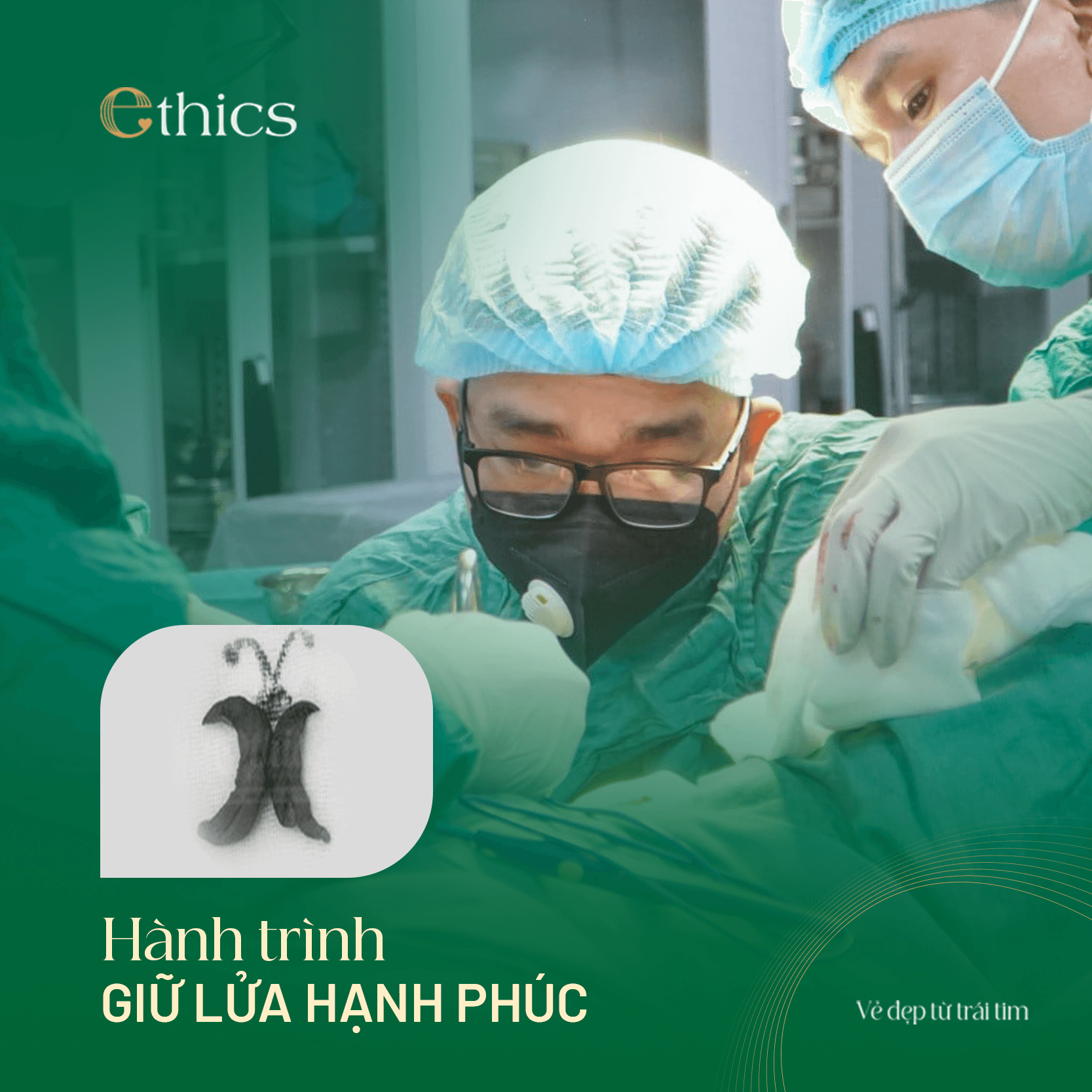 Augmentation labiale importante