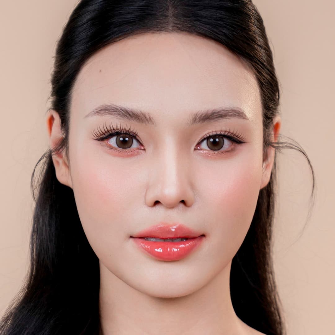 Patiente Lưu Phương Anh - Après rhinoplastie One fit