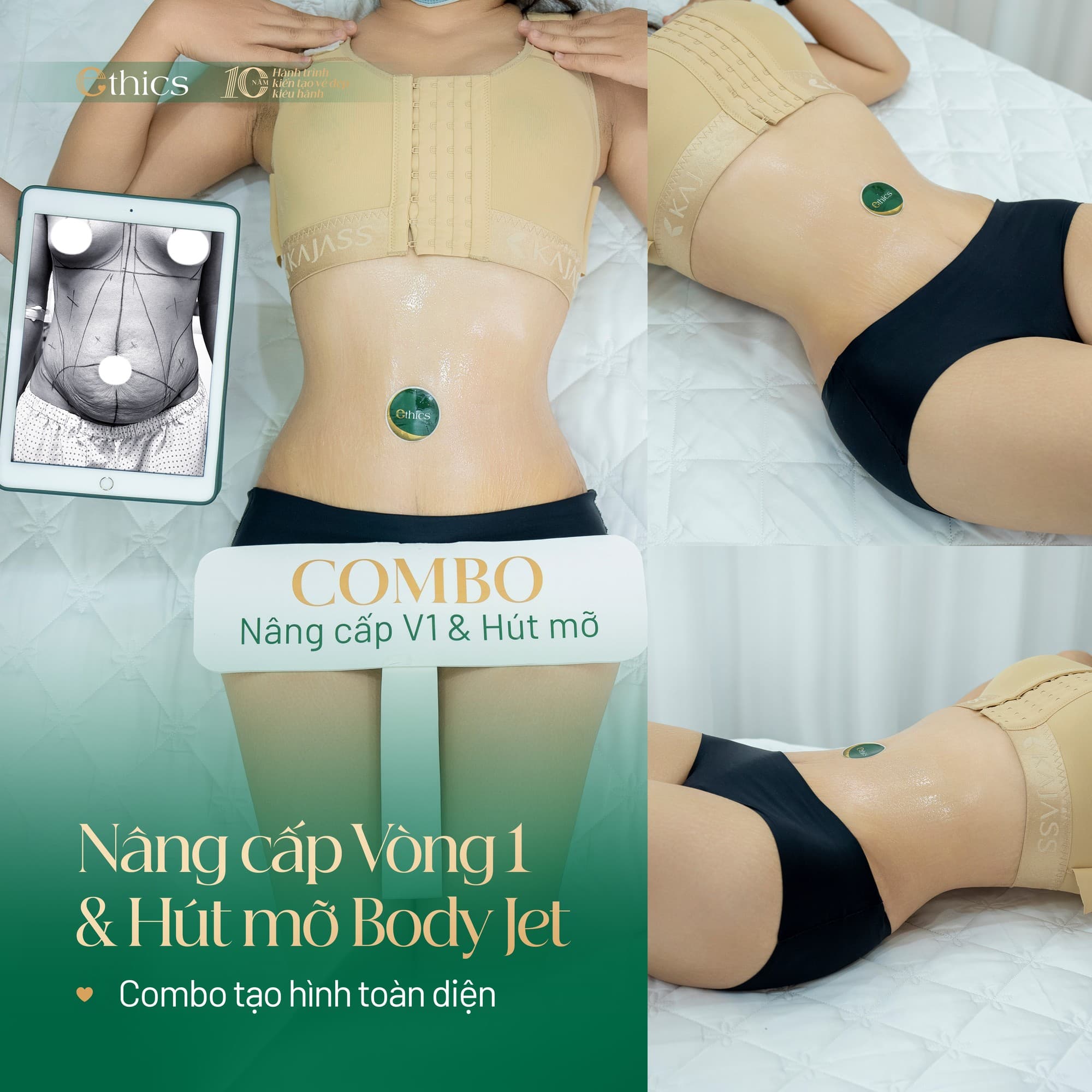 Retrait des implants mammaires