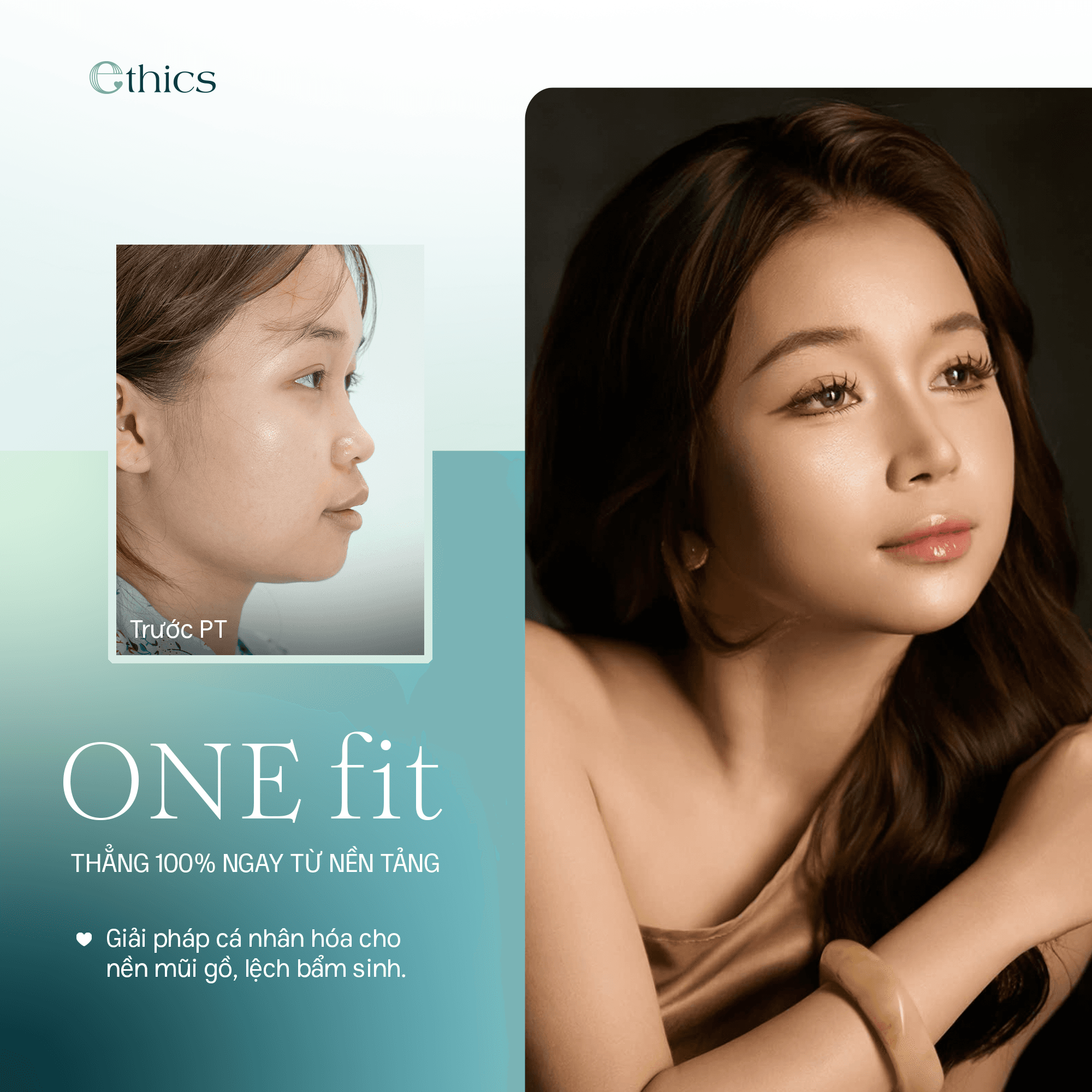Implants mentonaires OneFit