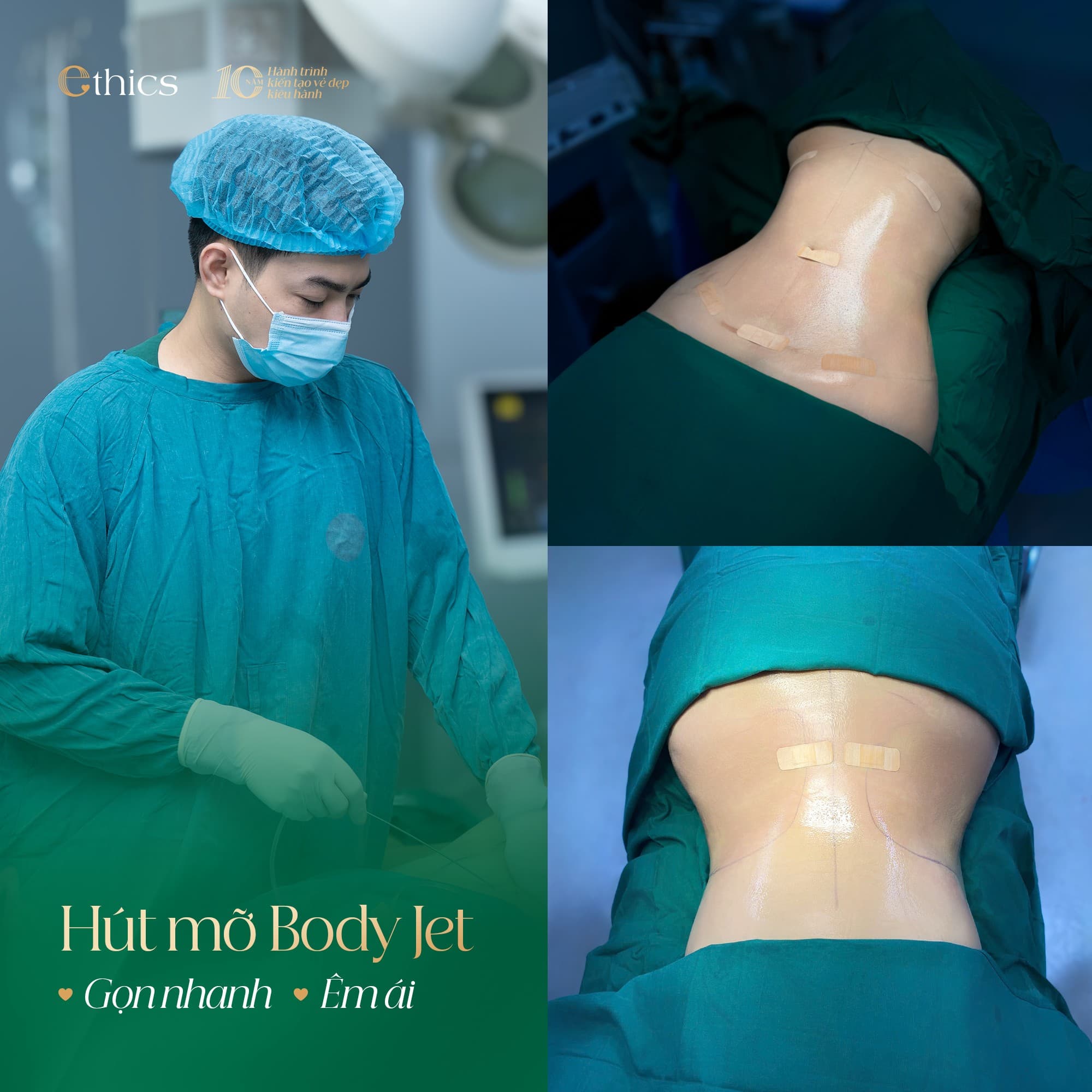 Liposuccion Slim Fit