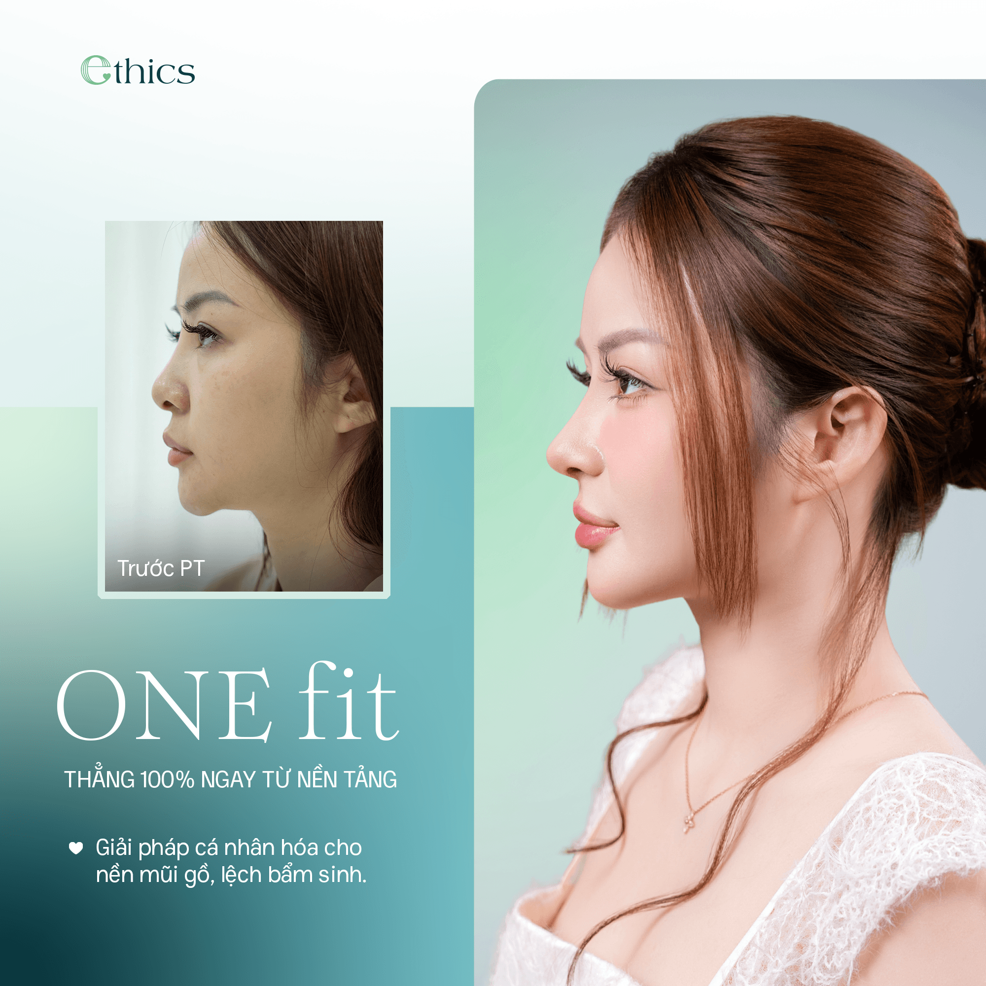Rhinoplastie OneFit Premium